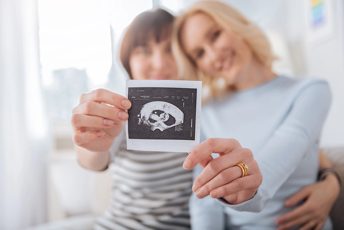 Two women holding up an ultrasound scan of a baby