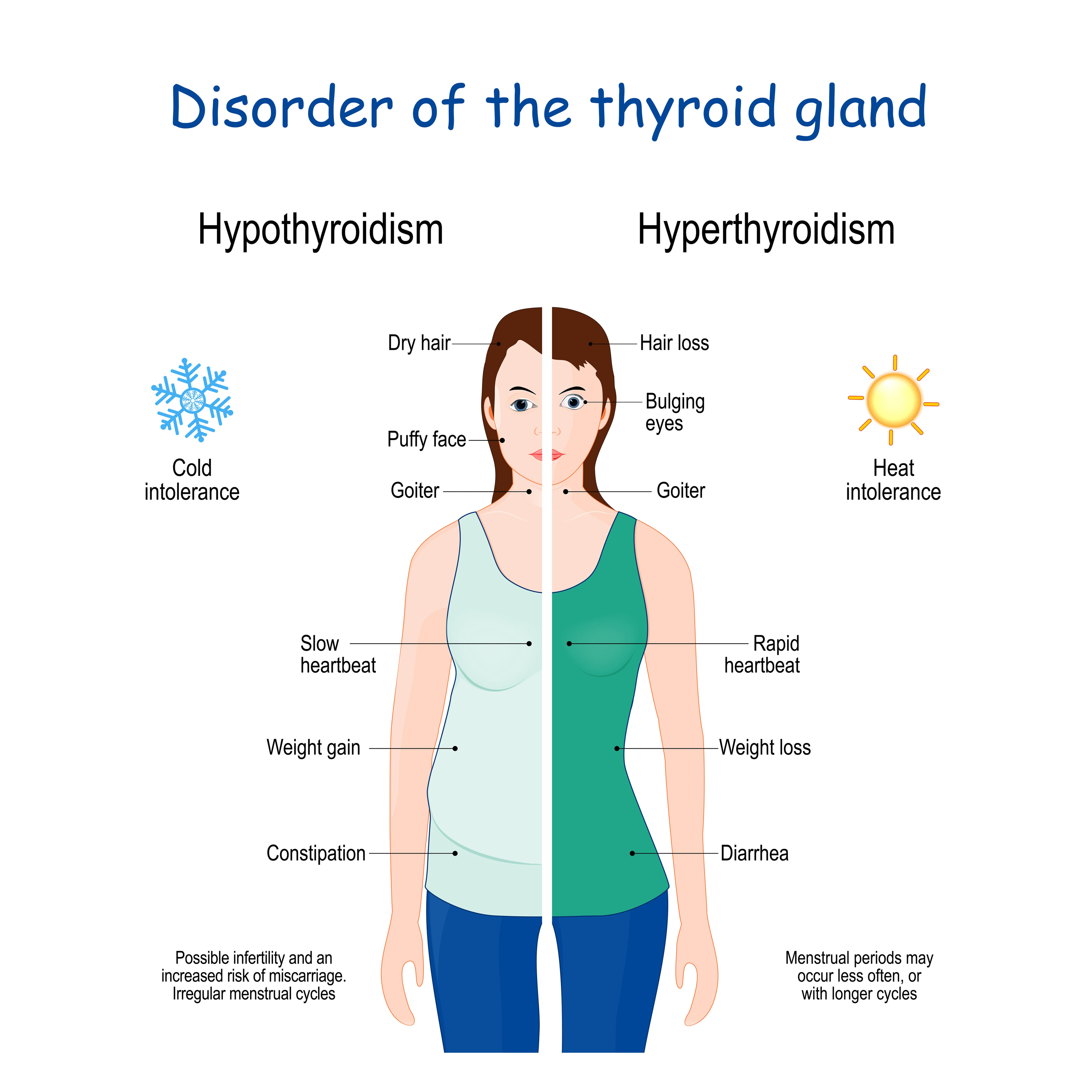 Thyroid disease can cause weight gain or loss, fatigue, feeling of anxiety, hair loss, and insomnia. In addition, it can cause significant reproductive issues by affecting ovulation. Thus, women with hormone disorders may not release an egg once a month during the menstrual cycle, which makes it difficult to conceive.